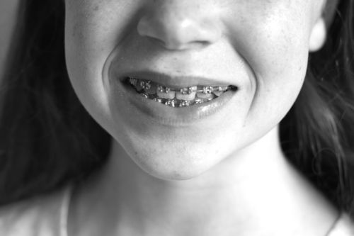 maudebraces1